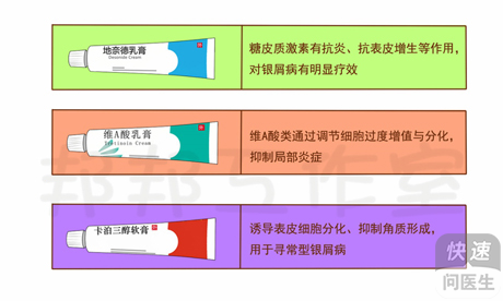 银屑病怎样治疗？科学用药是关键