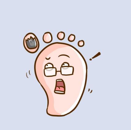 怎样去除脚上的灰指甲