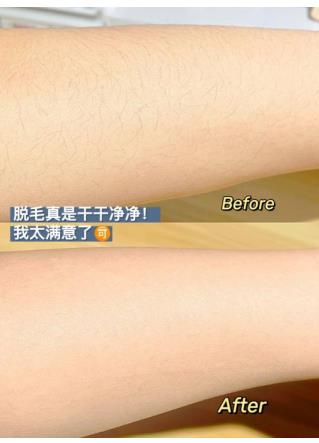 脱毛蜡纸怎么用脱毛效果好