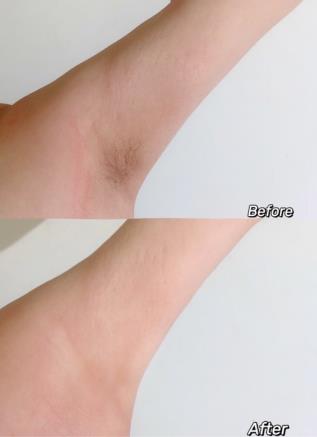 薇婷脱毛膏用完有氨臭吗