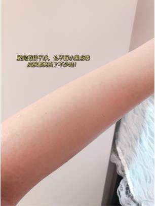 腿毛有点多，怎么去腿毛