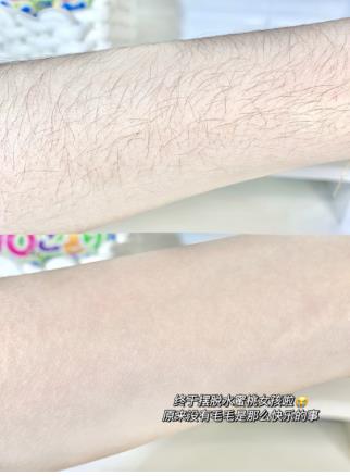 薇婷脱毛膏使用方法腋下脱毛很轻松