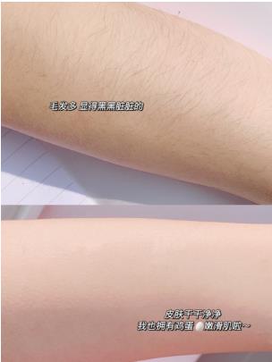 有没有学生脱毛的最快方法