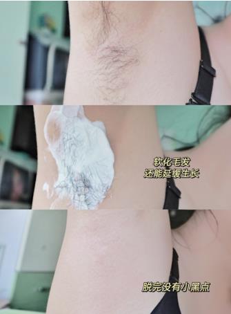 每天一问：女孩子到底要不要脱毛