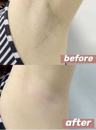 薇婷沐浴用脱毛膏怎么用你了解吗