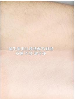 脱毛蜡纸可以永久脱毛吗