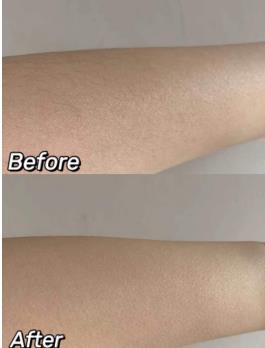 薇婷脱毛蜡纸守住你的娇嫩肌肤