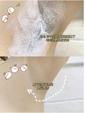 夏日来临，学生脱毛的最快方法