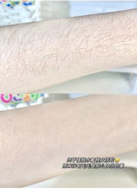 你知道脱毛用哪种方法好