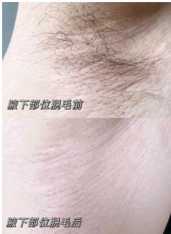 薇婷脱毛膏用完有氨臭是真的吗？