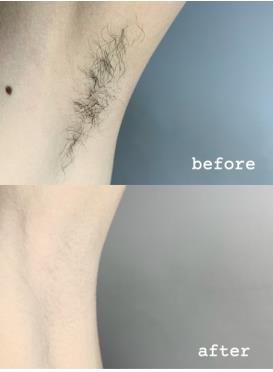 你知道薇婷脱毛蜡纸怎么洗掉吗？