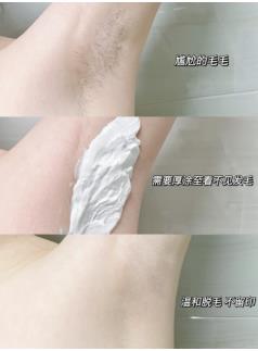 在家里如何脱毛比较安全便捷
