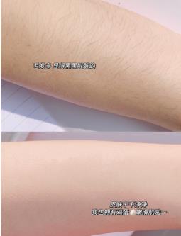 为什么薇婷脱毛膏受到大家欢迎