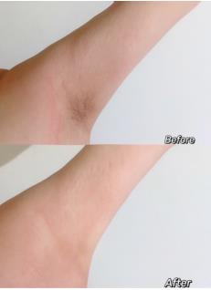 脱毛干货：女生脱毛膏推荐