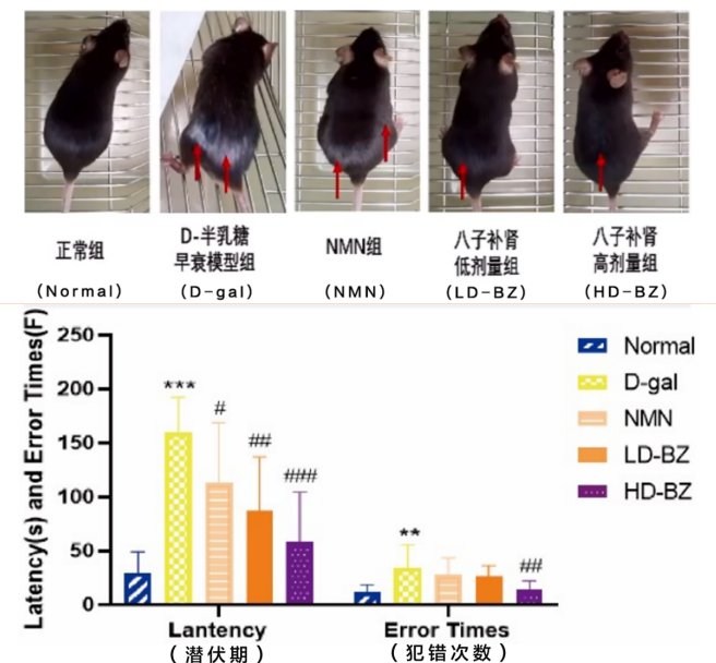 抗脑衰吃什么药效果好？