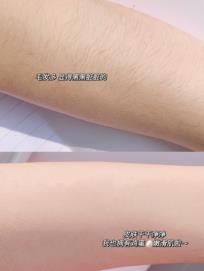 你知道脱毛的最好方法是什么