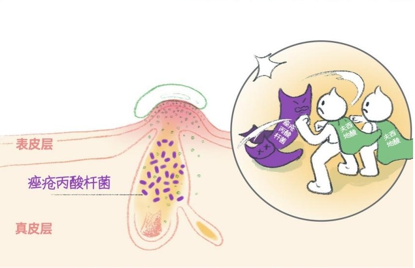 网红小绿膏，奥络夫西地酸乳膏能治什么病