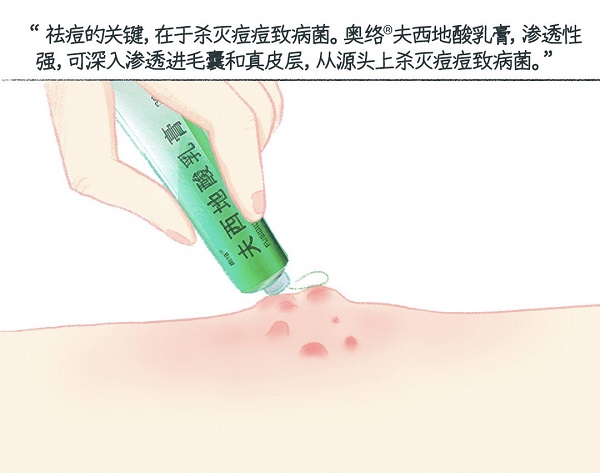 健康管理：玫瑰痤疮用祛痘的产品管用不