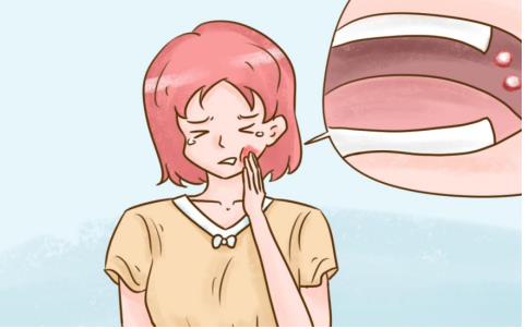 曲安奈德口腔软膏的主要成分是什么？来了解一下吧