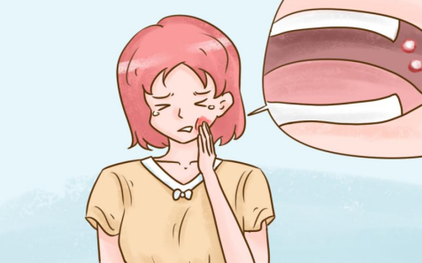 口腔溃疡白色创面用什么药好？宁之助帮您解决！