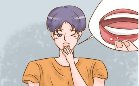 口腔溃疡白色的创面用什么管用？快来了解一下吧