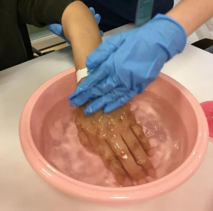 康复中心不光要做身体的康复，还要重建患者信心