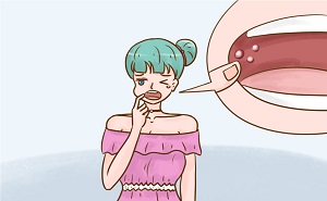 什么治疗口腔溃疡效果好？意可贴值得大家选择