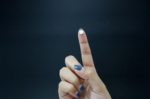 什么药治疗口腔溃疡好？