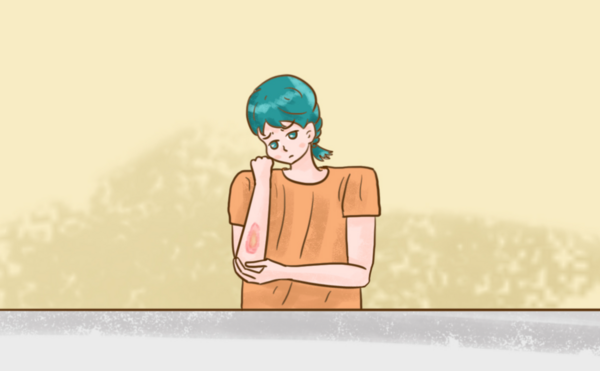 抑制瘢痕可以用京万红软膏吗？