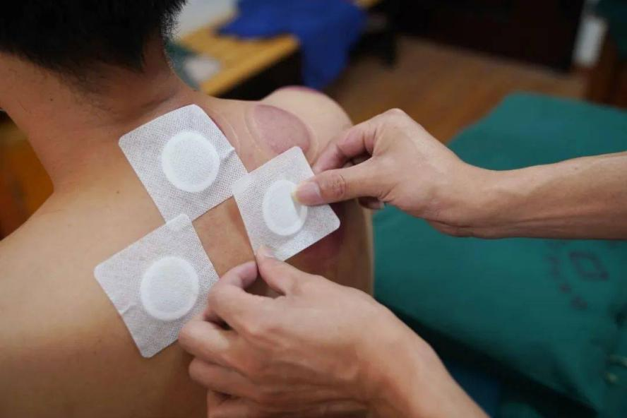 三伏天养生潮，京万红解锁冬病夏治的新玩法