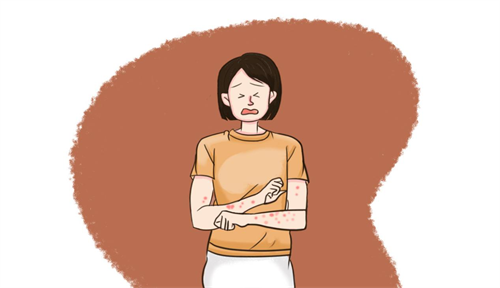 皮肤过敏痒一招就消除的方法被我找到了！