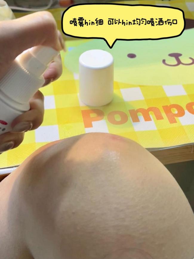 磕到腿可以用伤科灵吗