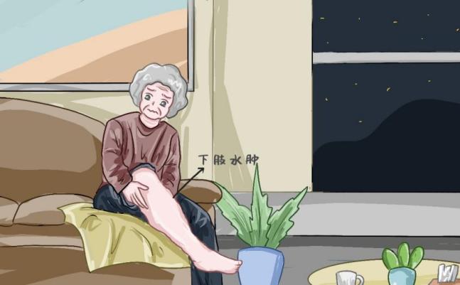 心衰脚肿吃什么中药消肿快