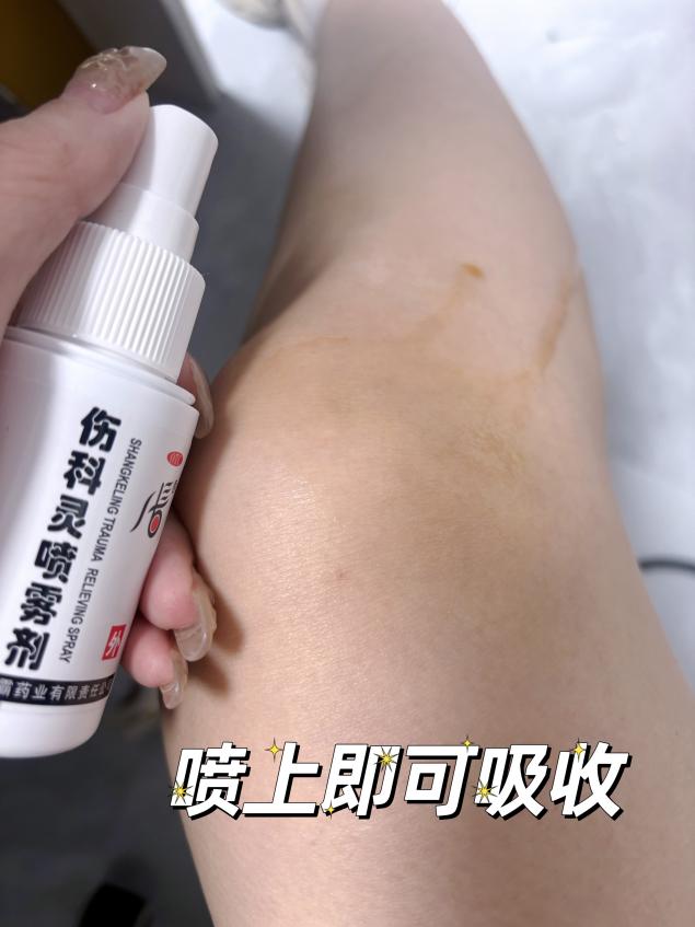 小腿挫伤多久能恢复，用什么药更好