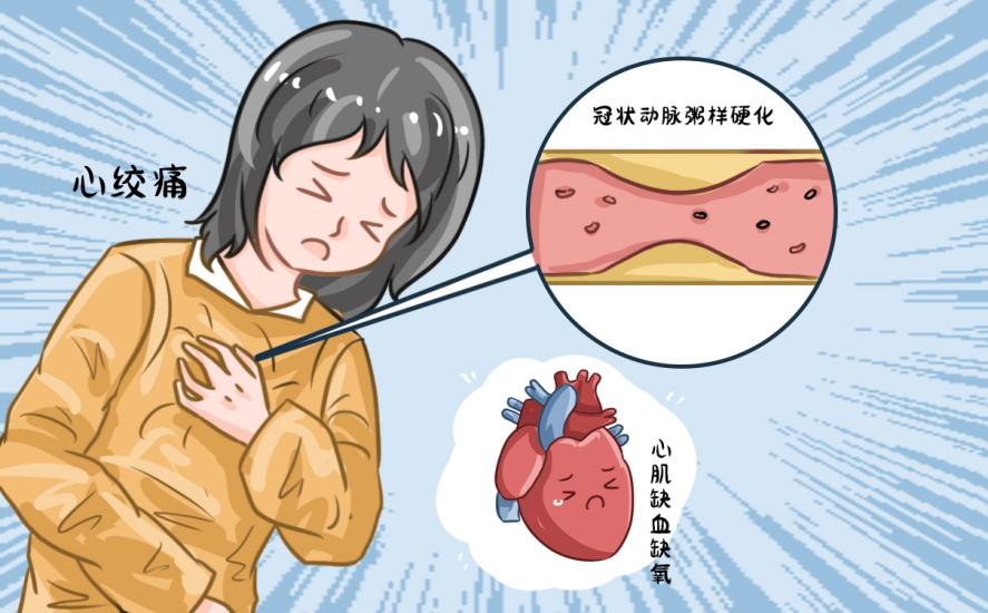 618购物节熬夜抢单？小心“交感风暴”诱发心绞痛！