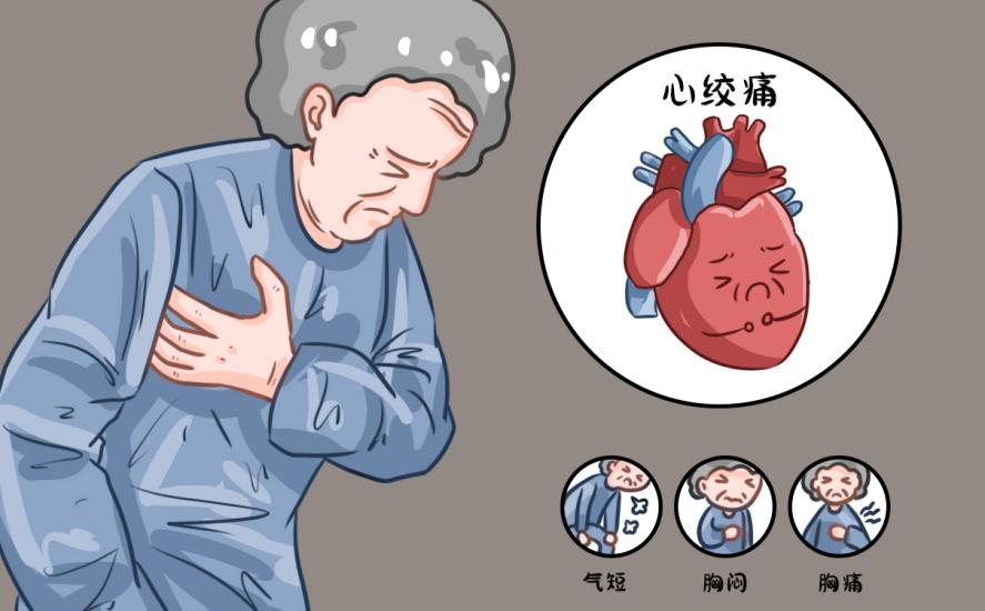 空调房VS户外高温，温差易致血管痉挛！心绞痛患者注意