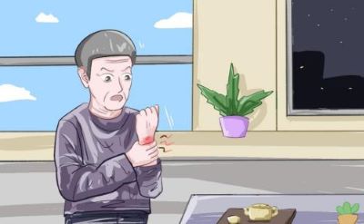 腱鞘炎一般在哪个部位？