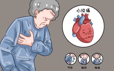 心绞痛的临床表现及急救方法：识别与应对的全面指南