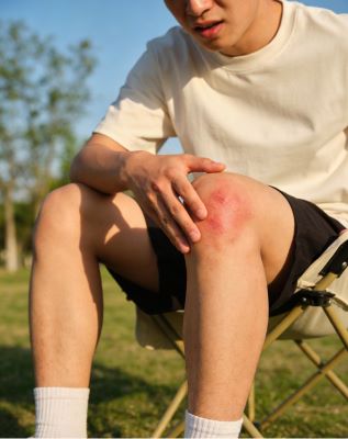 伤科灵喷雾剂怎么样？