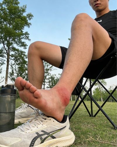 伤科灵有什么用？