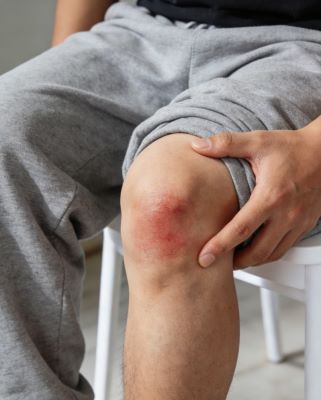 伤科灵的作用与功效有哪些？