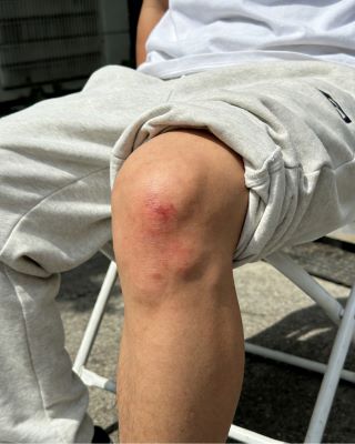 伤科灵的功效与作用解读，带你了解其实用价值