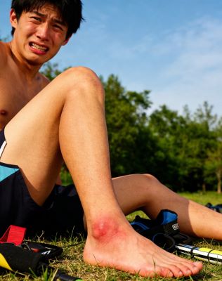 伤科灵喷雾剂能止痛吗？